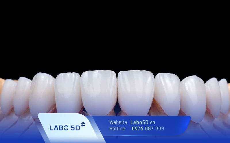 Răng sứ Cercon HT là gì? Có tốt không? Giá bao nhiêu tiền?